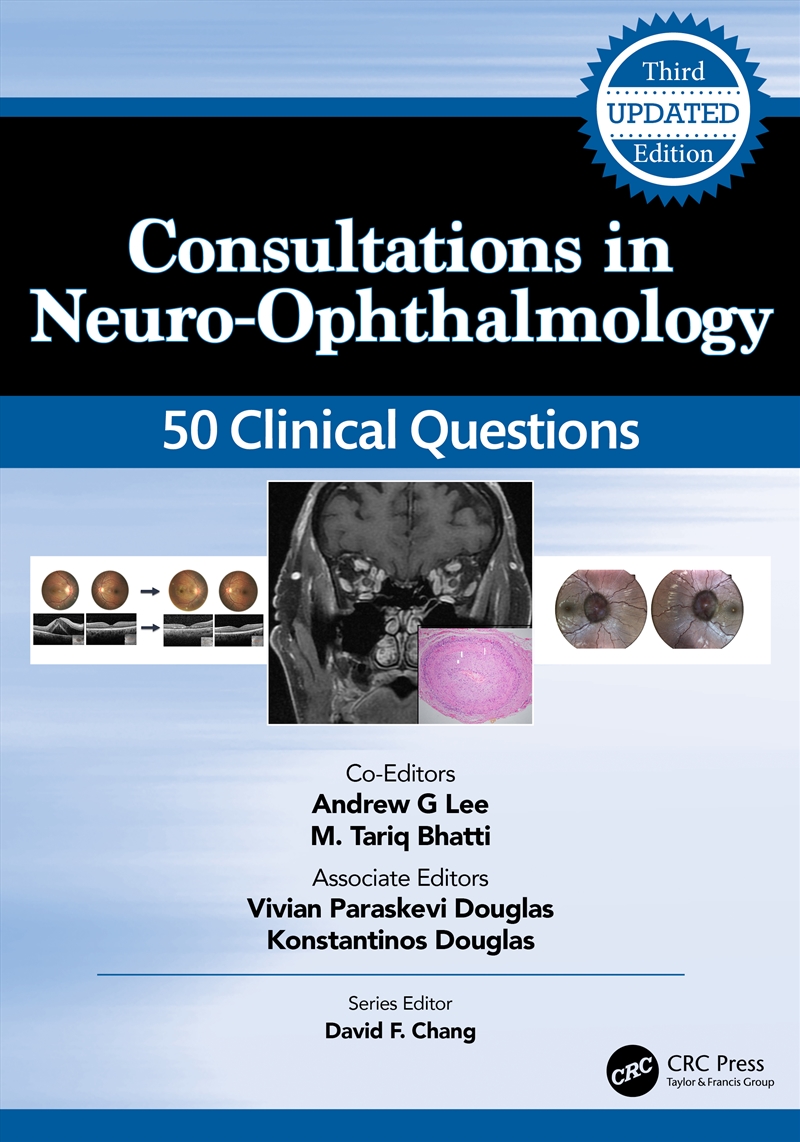Consultations in Neuro-Ophthalmology/Product Detail/Healthcare