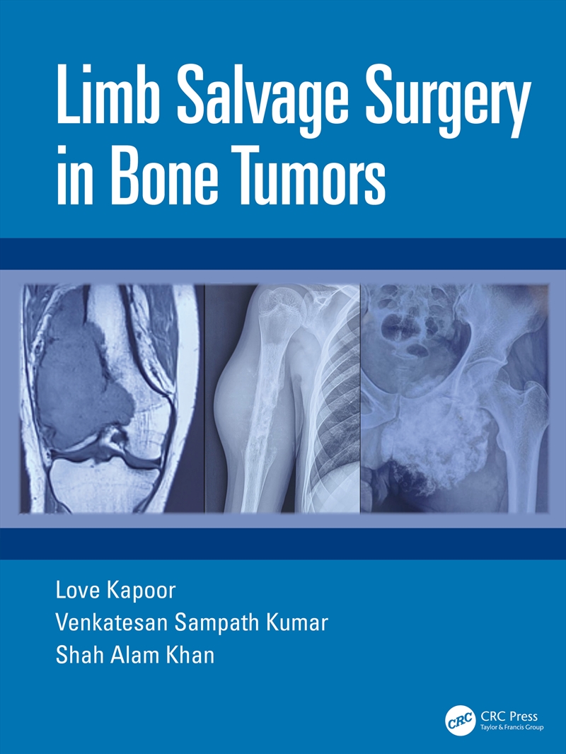 Limb Salvage Surgery in Bone Tumors/Product Detail/Healthcare