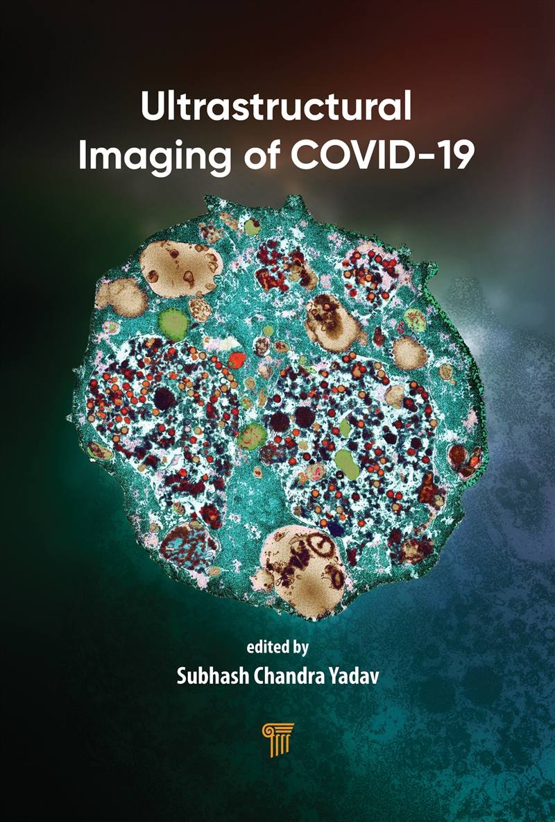 Ultrastructural Imaging of COVID-19/Product Detail/Healthcare