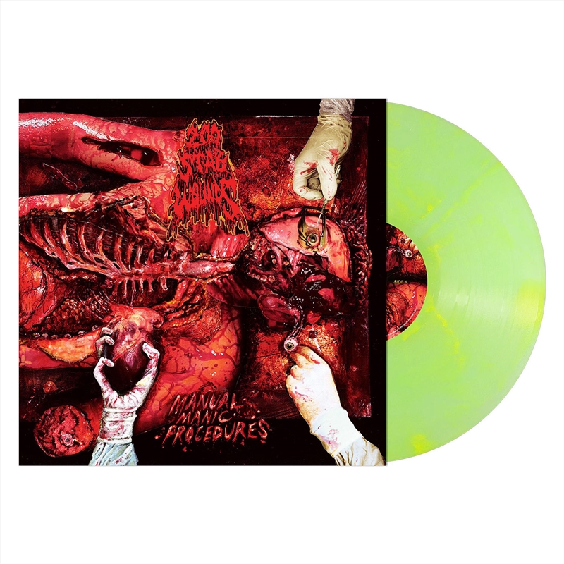 Manual Manic Procedures - Plutonium Green / Yellow Marble Vinyl/Product Detail/Metal