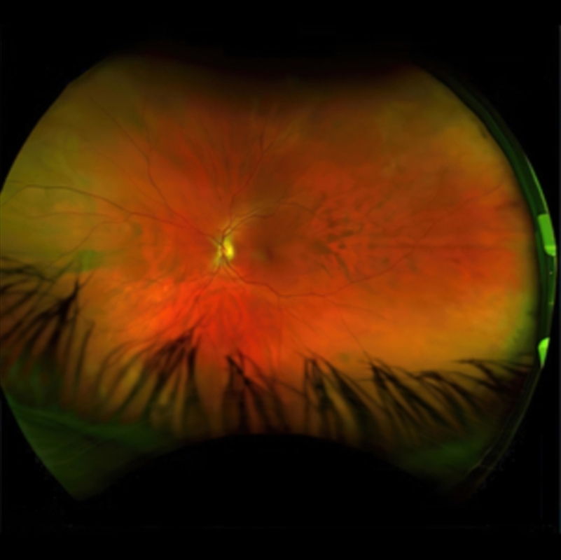 Mirrorcell/Product Detail/Rock/Pop