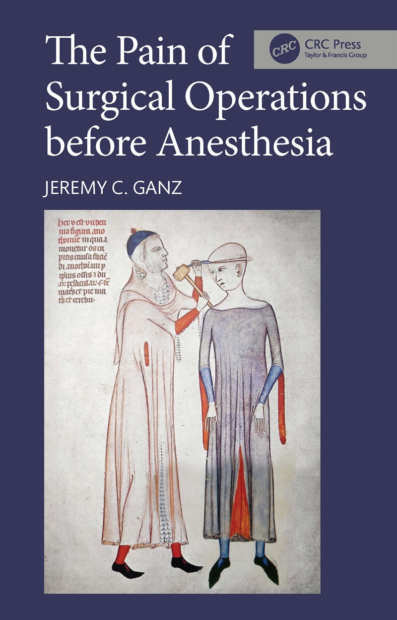 The Pain of Surgical Operations before Anesthesia/Product Detail/Healthcare
