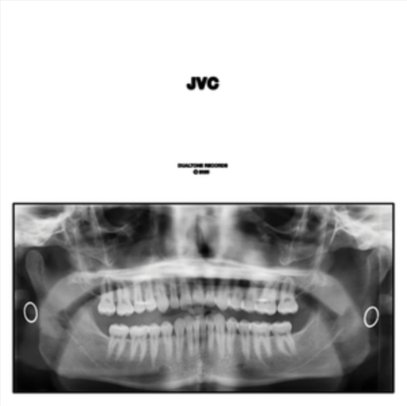 Jvc/Product Detail/Rock/Pop