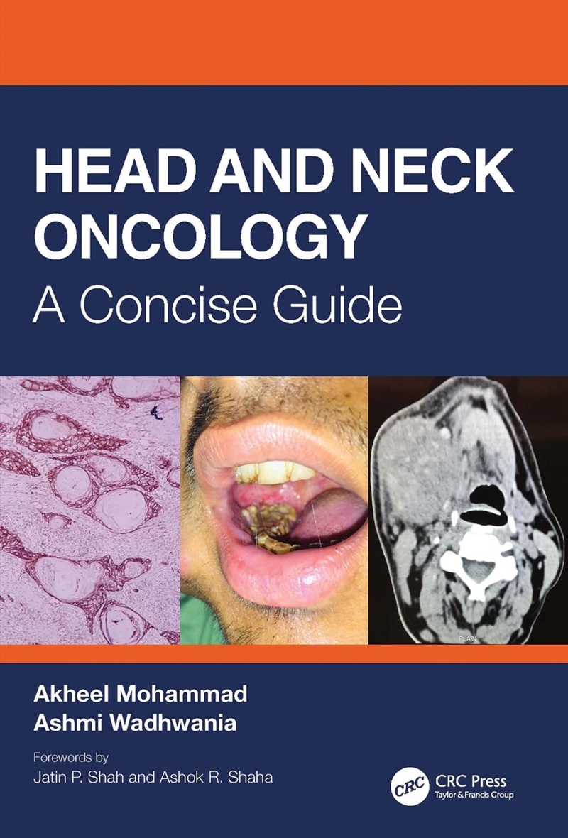 Head and Neck Oncology/Product Detail/Healthcare