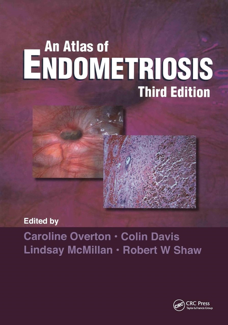 Atlas of Endometriosis/Product Detail/Healthcare