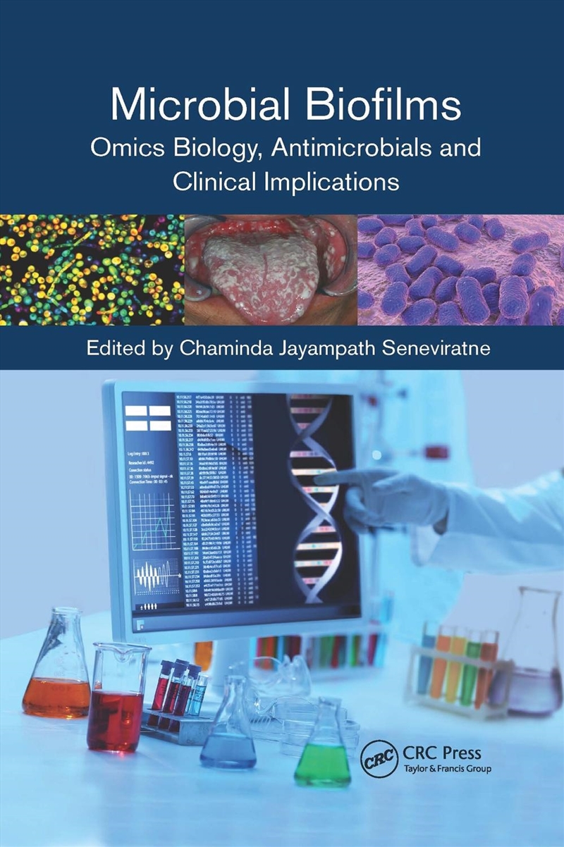 Microbial Biofilms/Product Detail/Healthcare