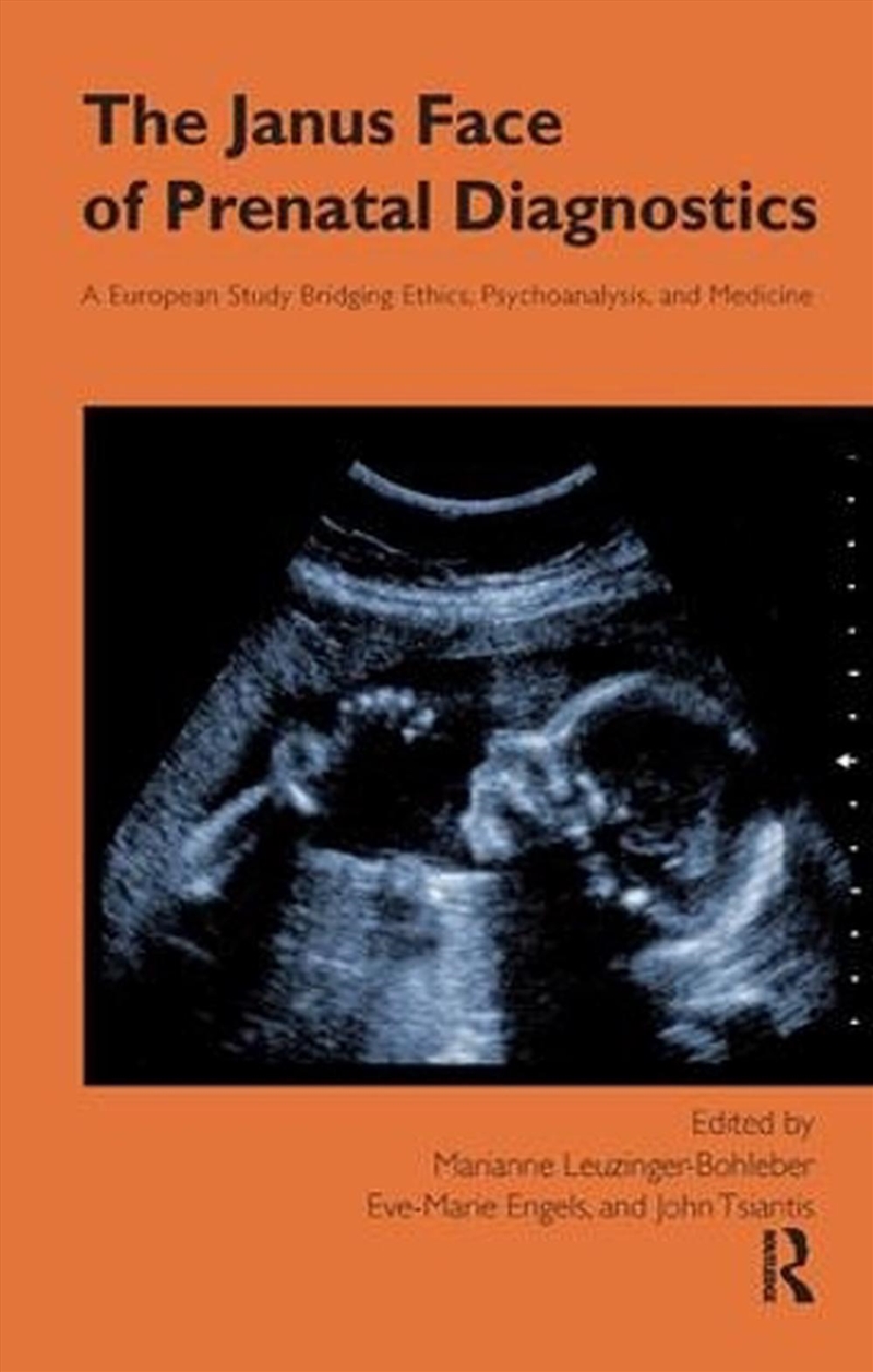 Janus Face of Prenatal Diagnostics/Product Detail/Healthcare