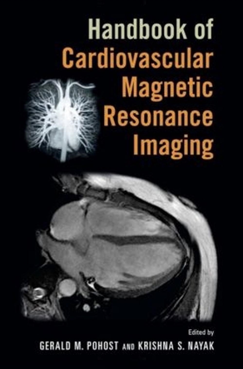 Handbook of Cardiovascular Magnetic Resonance Imaging/Product Detail/Healthcare