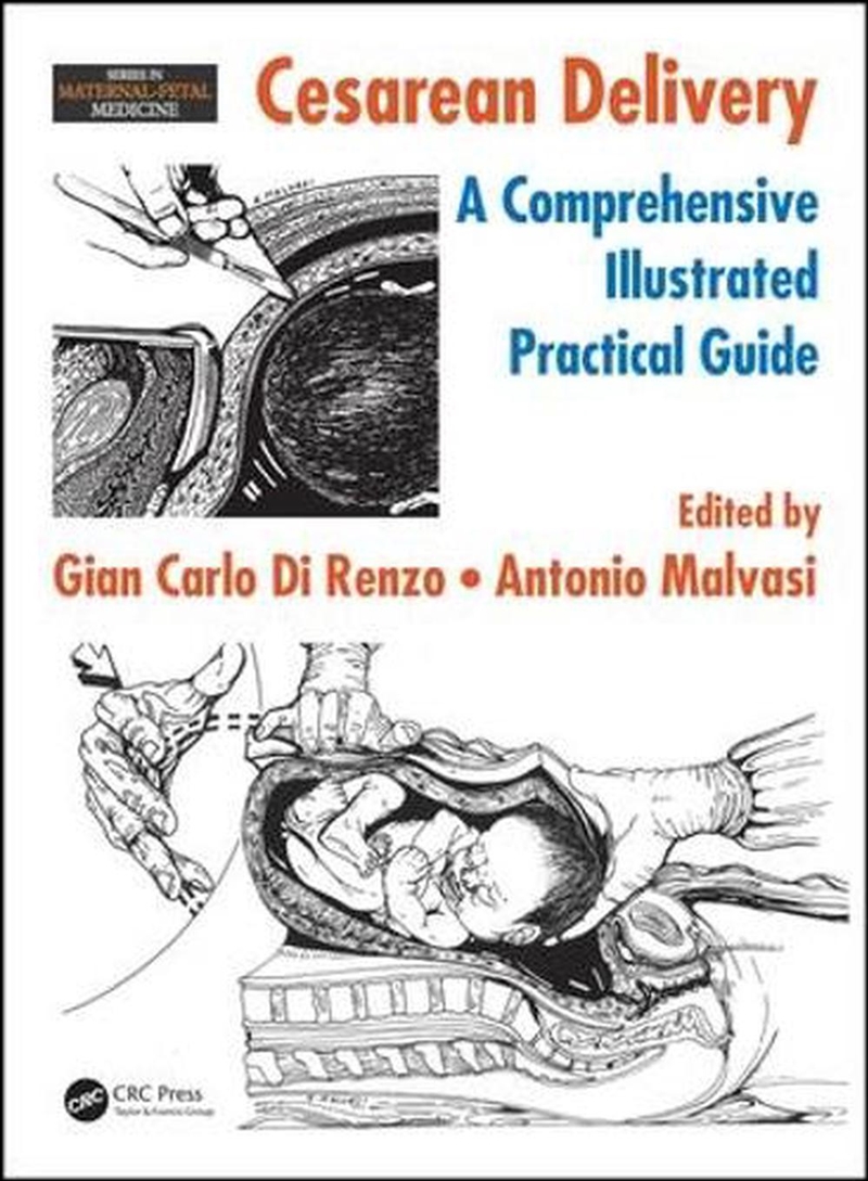 Cesarean Delivery/Product Detail/Healthcare