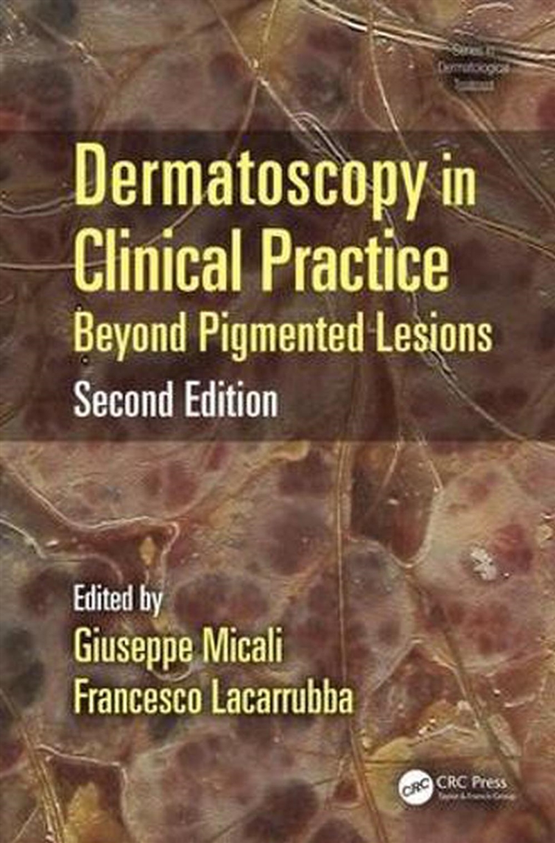 Dermatoscopy in Clinical Practice/Product Detail/Healthcare
