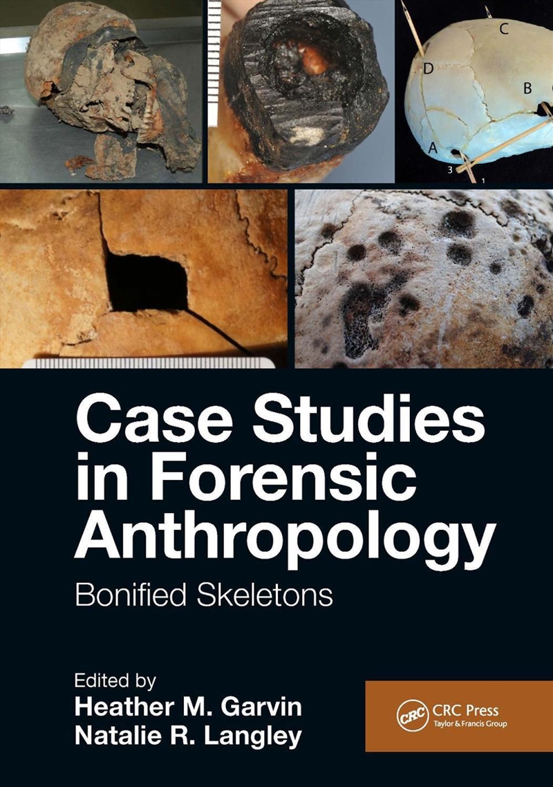 Case Studies in Forensic Anthropology/Product Detail/Science