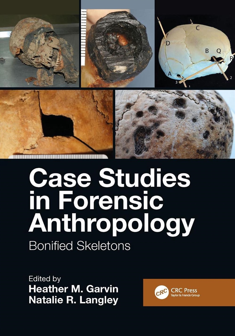 Case Studies in Forensic Anthropology/Product Detail/Science