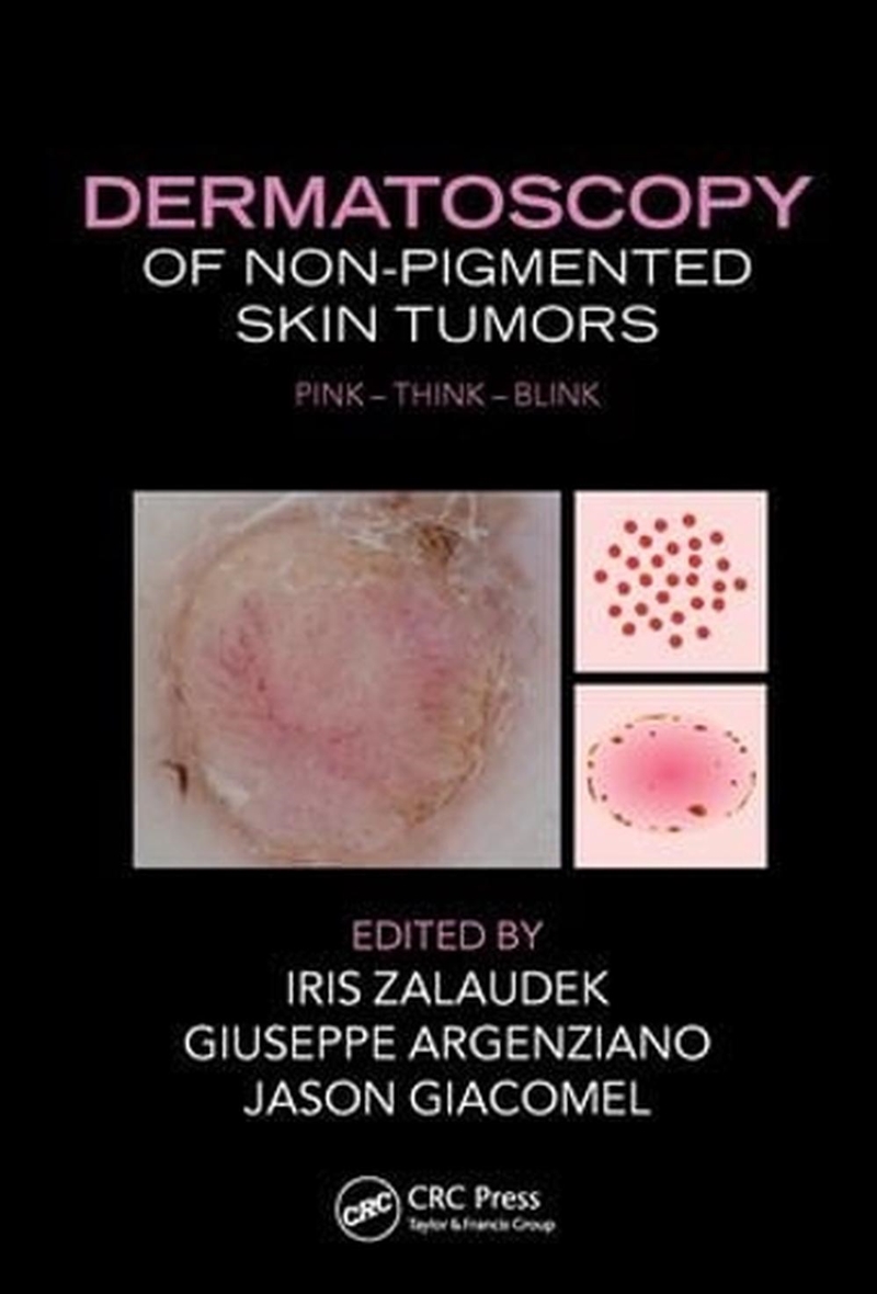 Dermatoscopy of Non-Pigmented Skin Tumors/Product Detail/Healthcare