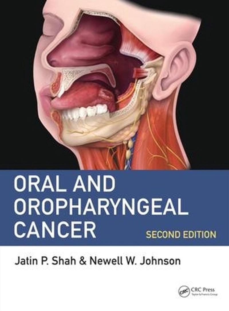 Oral and Oropharyngeal Cancer/Product Detail/Healthcare