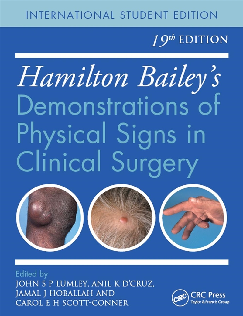 Hamilton Bailey's Physical Signs/Product Detail/Healthcare