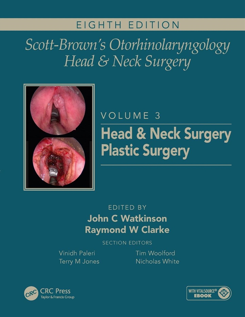 Scott-Brown's Otorhinolaryngology and Head and Neck Surgery/Product Detail/Healthcare