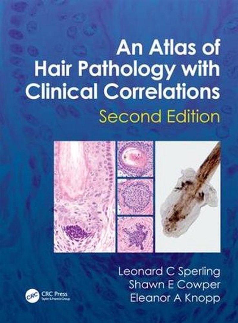 Atlas of Hair Pathology with Clinical Correlations/Product Detail/Healthcare