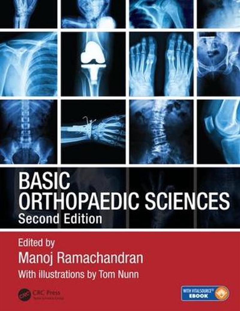 Basic Orthopaedic Sciences/Product Detail/Healthcare