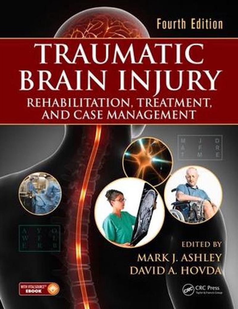 Traumatic Brain Injury/Product Detail/Healthcare