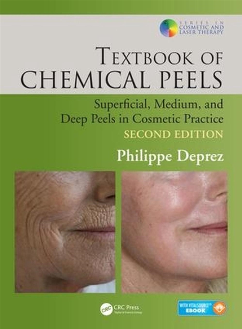 Textbook of Chemical Peels/Product Detail/Healthcare