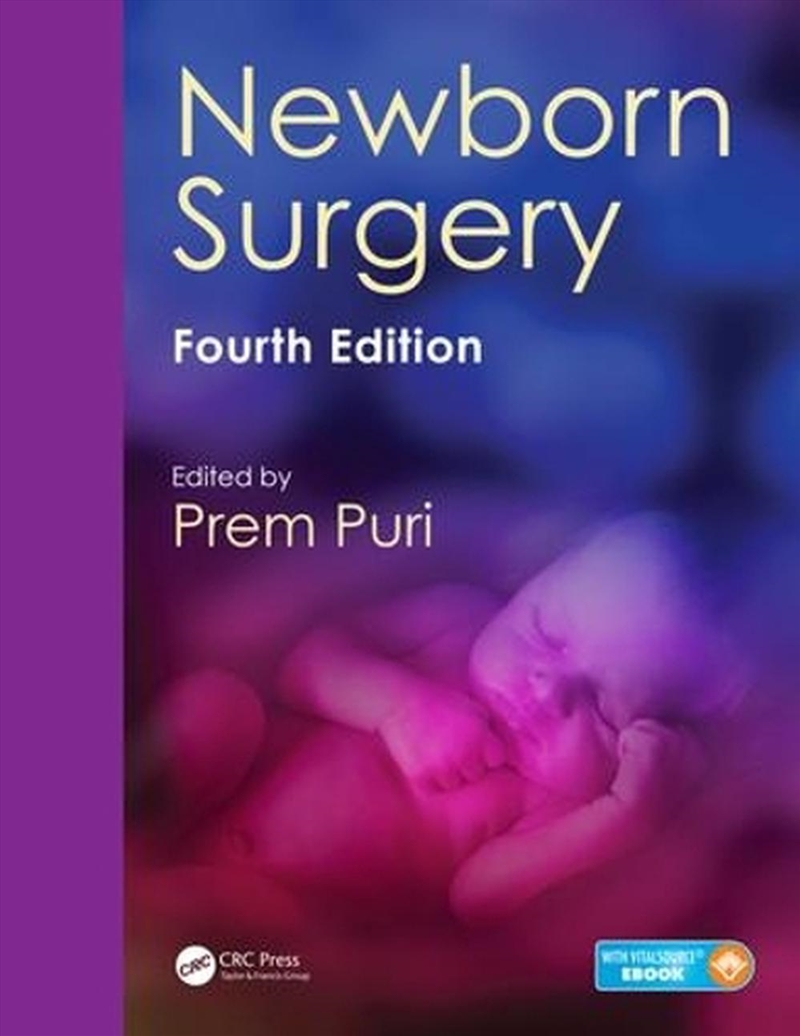 Newborn Surgery/Product Detail/Healthcare