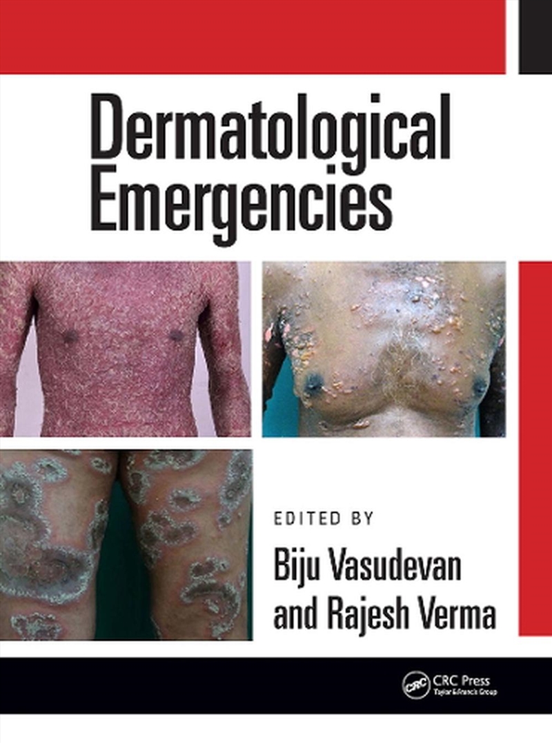 Dermatological Emergencies/Product Detail/Healthcare