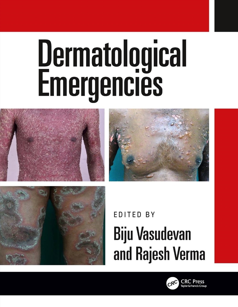 Dermatological Emergencies/Product Detail/Healthcare