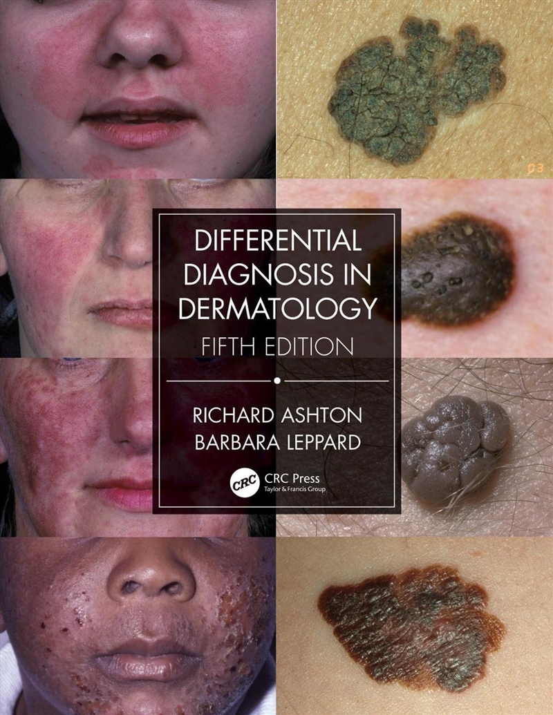 Differential Diagnosis in Dermatology/Product Detail/Healthcare