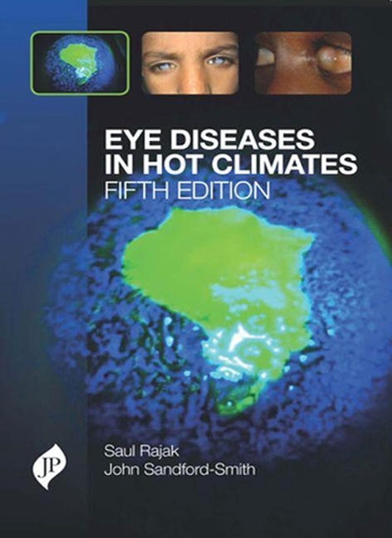 Eye Diseases in Hot Climates/Product Detail/Healthcare