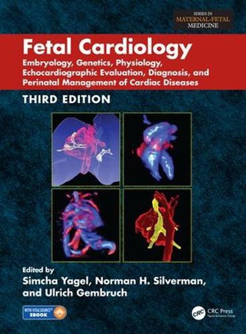 Fetal Cardiology/Product Detail/Healthcare