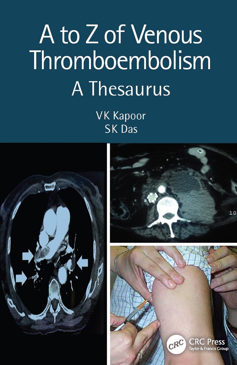 A to Z of Venous Thromboembolism/Product Detail/Healthcare