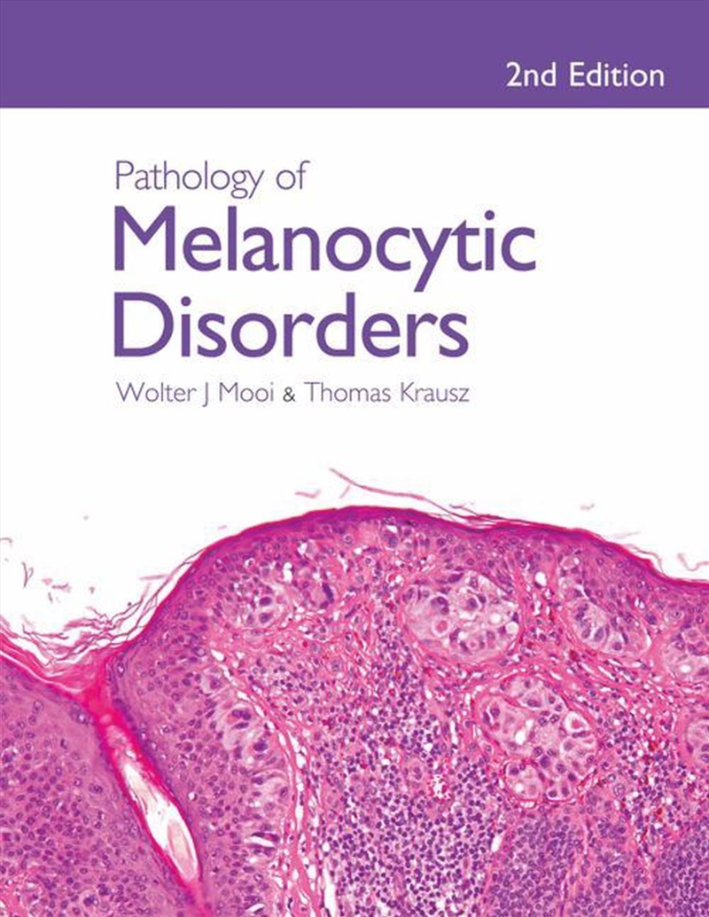 Pathology of Melanocytic Disorders 2ed/Product Detail/Healthcare