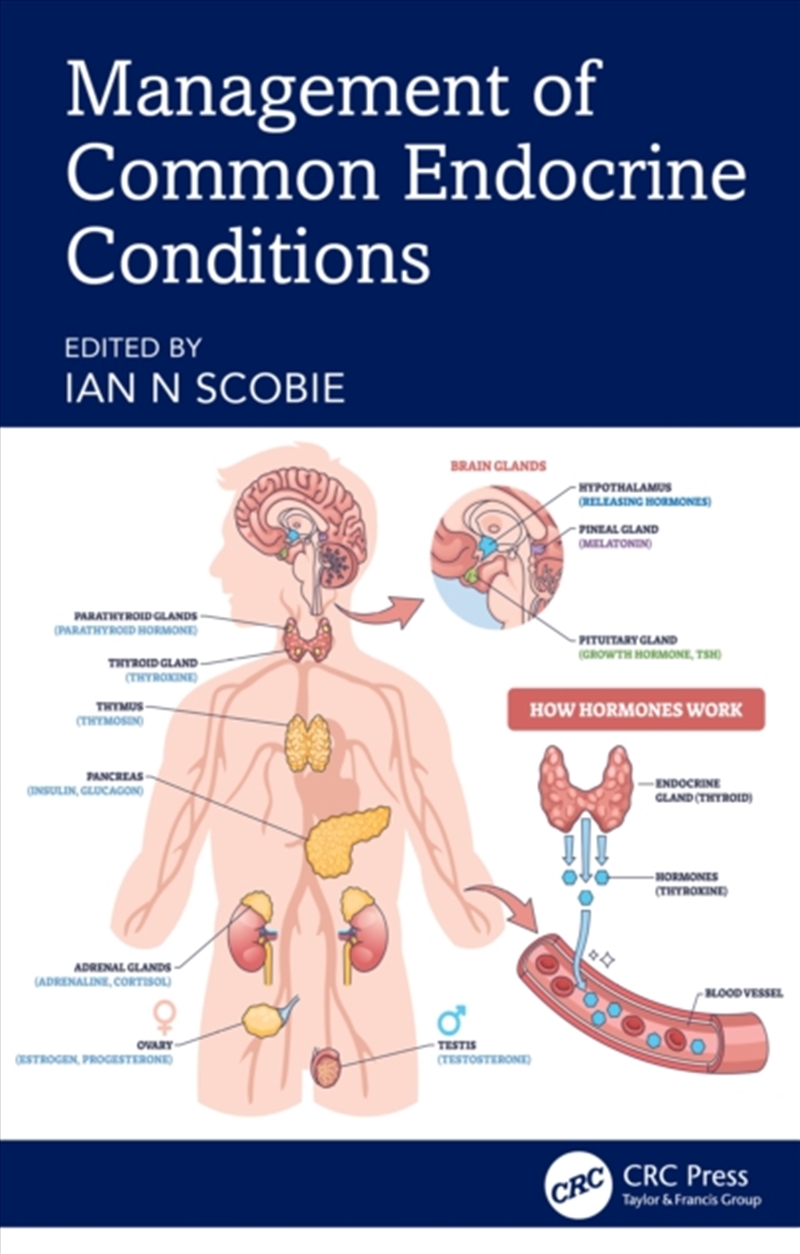 Management of Common Endocrine Conditions/Product Detail/Healthcare