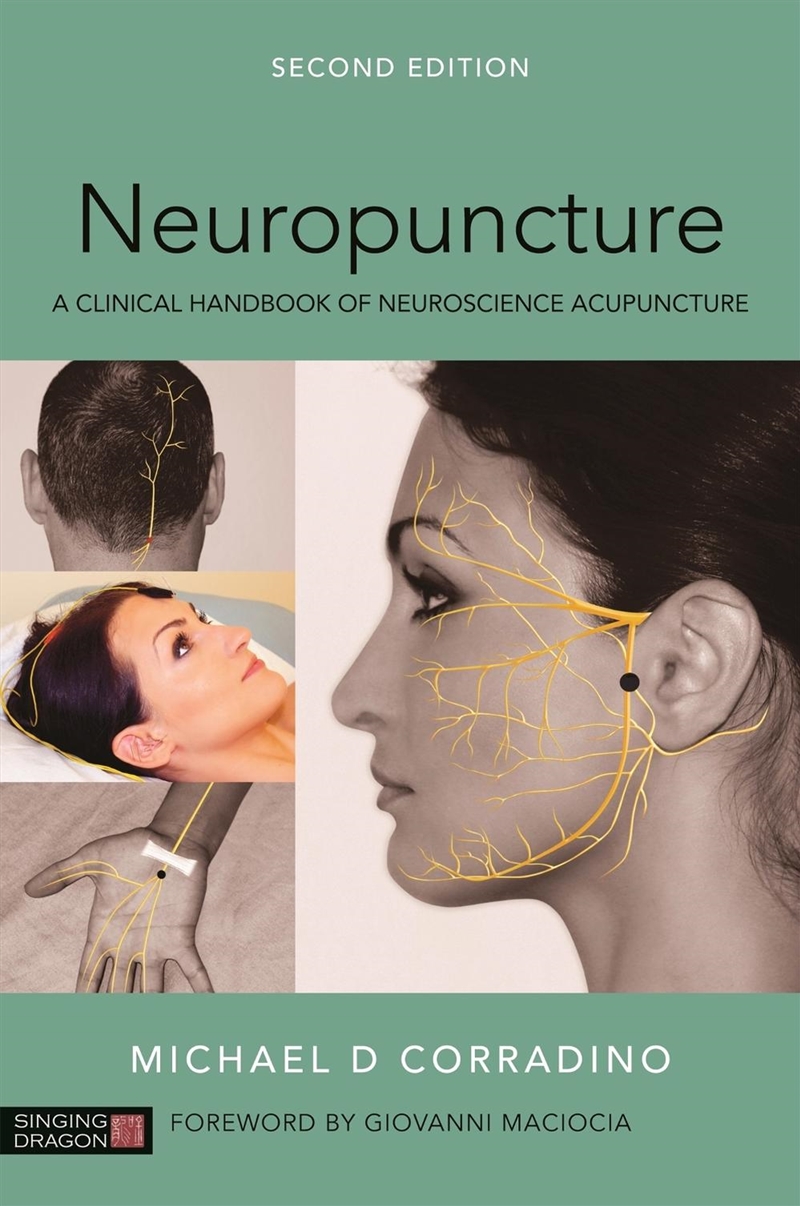 Neuropuncture/Product Detail/Healthcare
