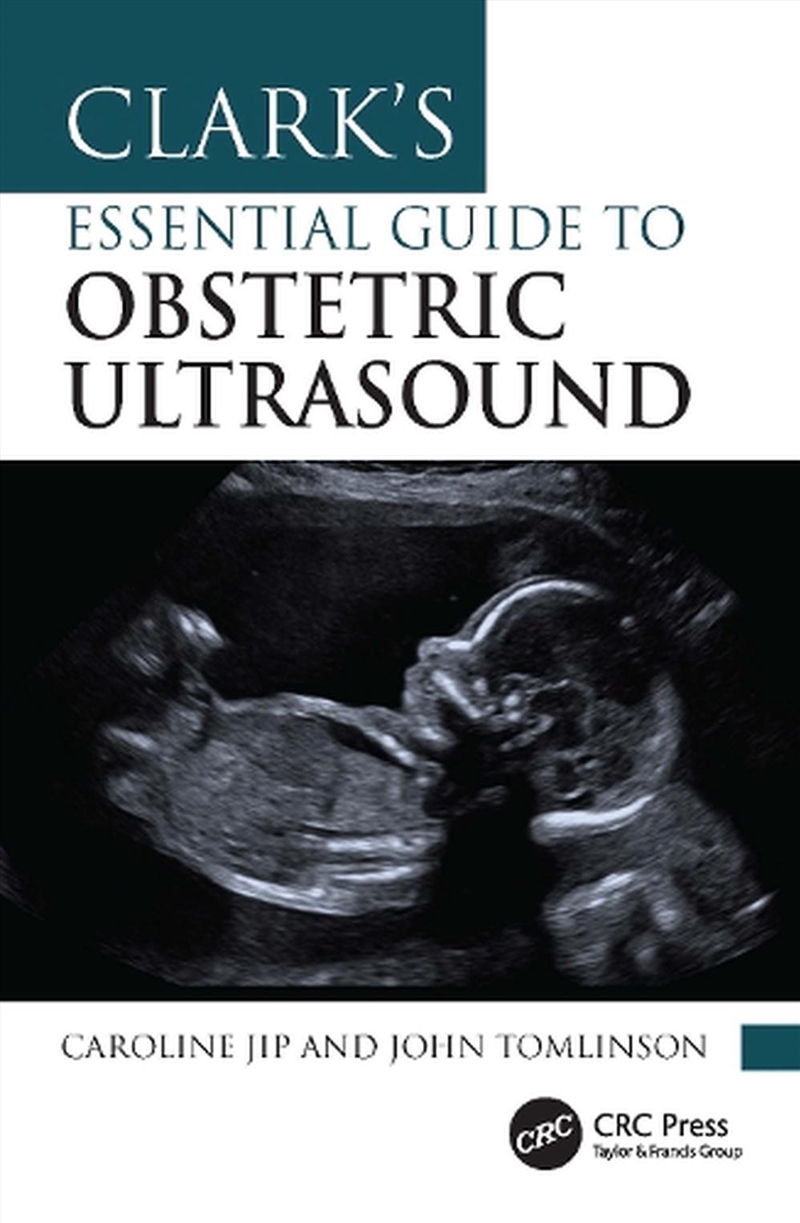 Clark's Essential Guide to Obstetric Ultrasound/Product Detail/Healthcare