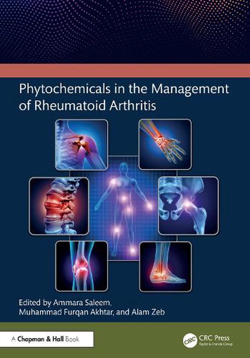 Phytochemicals in the Management of Rheumatoid Arthritis/Product Detail/Reading