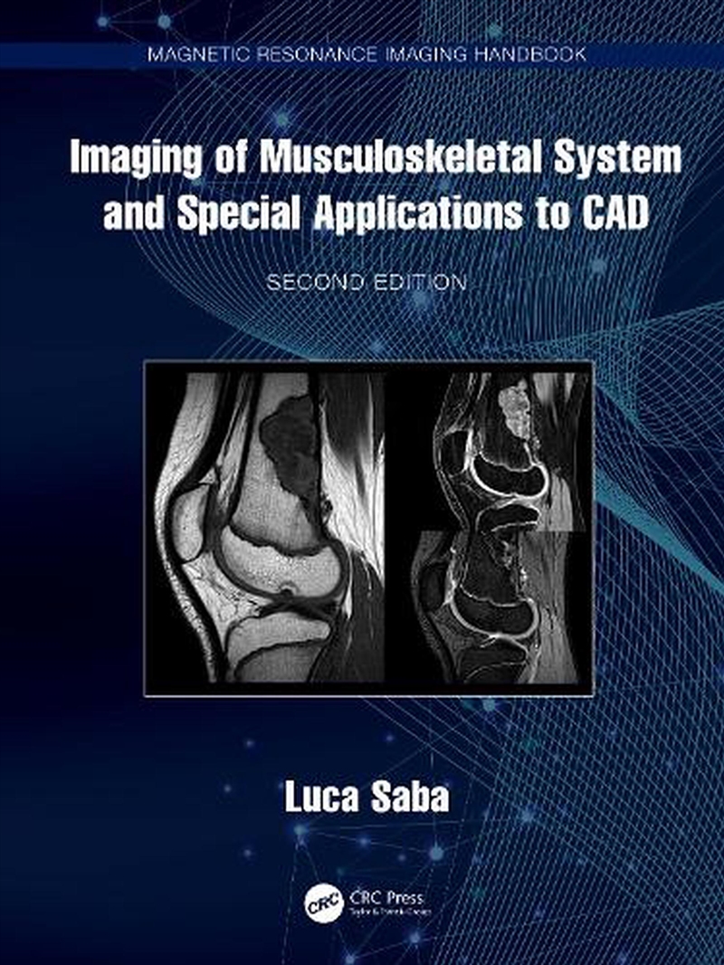 Imaging Of Musculoskeletal System And Special Applications To Cad/Product Detail/Healthcare