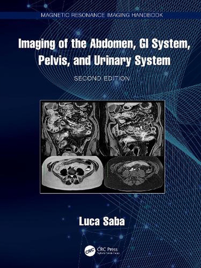 Imaging Of The Abdomen, Gi System, Pelvis, And Urinary System/Product Detail/Healthcare