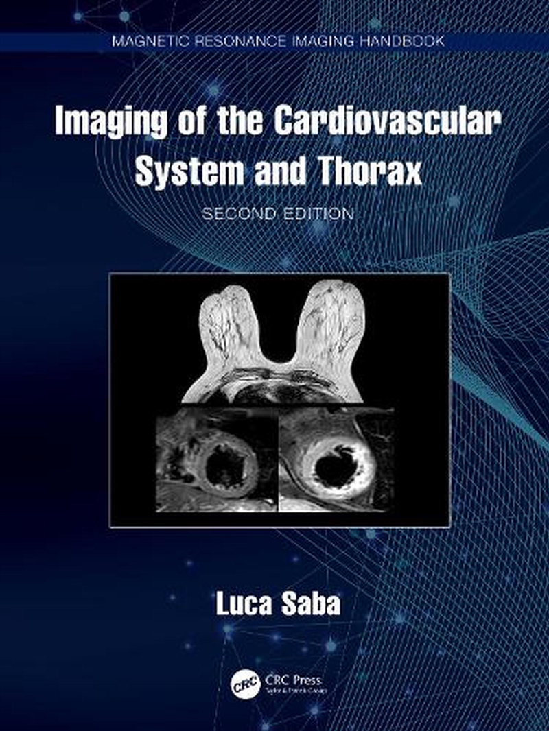Imaging Of The Cardiovascular System And Thorax/Product Detail/Healthcare