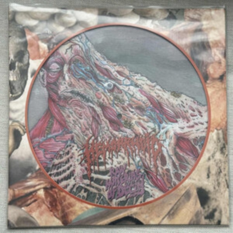 Raw Materials Of Decay/Product Detail/Metal