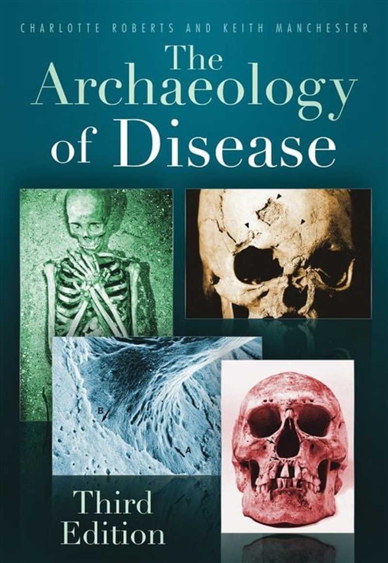 Archaeology of Disease/Product Detail/History