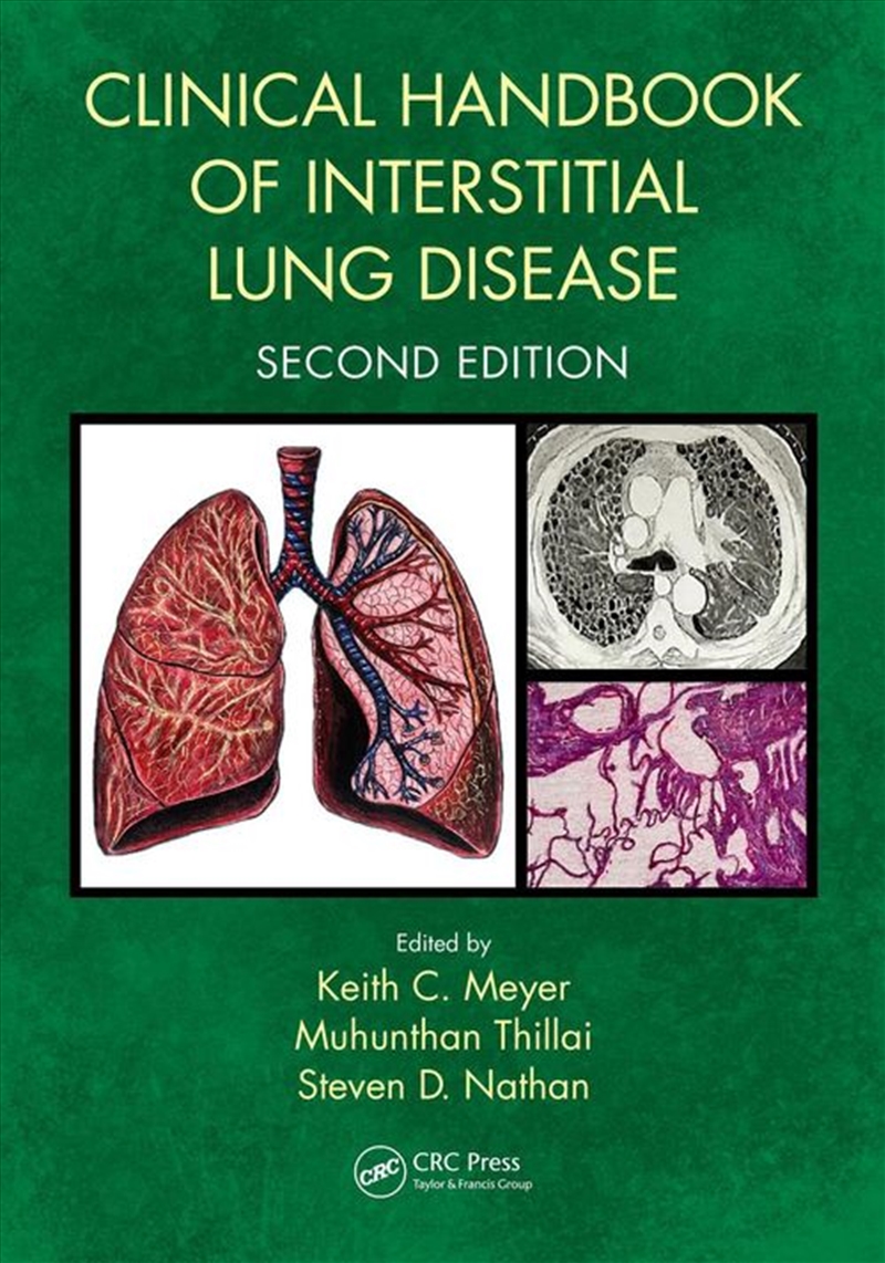 Clinical Handbook of Interstitial Lung Disease/Product Detail/Healthcare