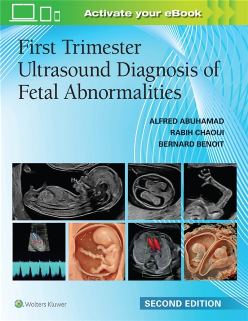 First Trimester Ultrasound Diagnosis Of Fetal Abnormalities/Product Detail/Healthcare