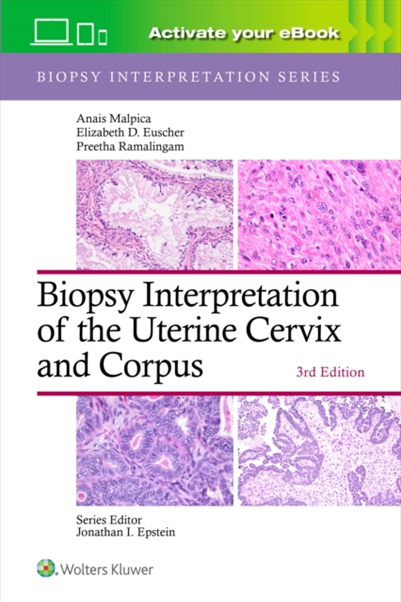 Biopsy Interpretation Of The Uterine Cervix And Corpus: Print + Ebook With Multimedia/Product Detail/Healthcare