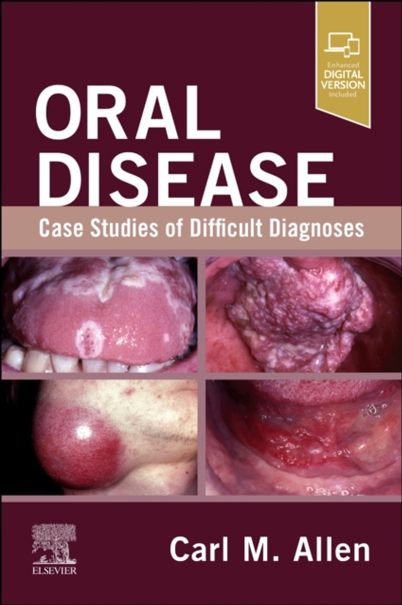 Oral Disease: Case Studies Of Difficult Diagnoses : Case Studies Of Difficult Diagnoses/Product Detail/Healthcare