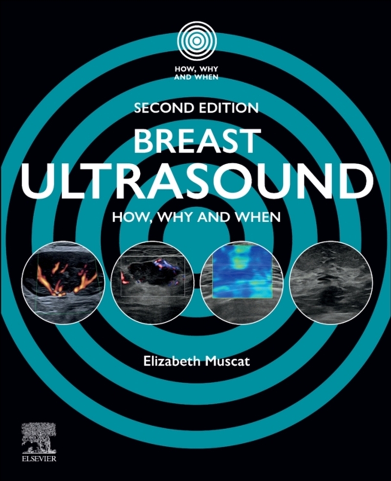 Breast Ultrasound : How, Why And When/Product Detail/Healthcare