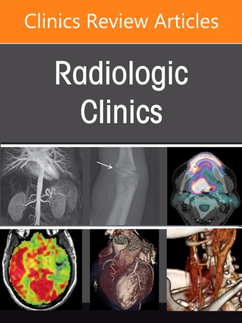 Imaging Of The Orbit, An Issue Of Radiologic Clinics Of North America : Volume 64-4/Product Detail/Healthcare