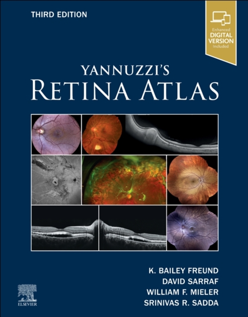 Yannuzzi's Retina Atlas/Product Detail/Healthcare