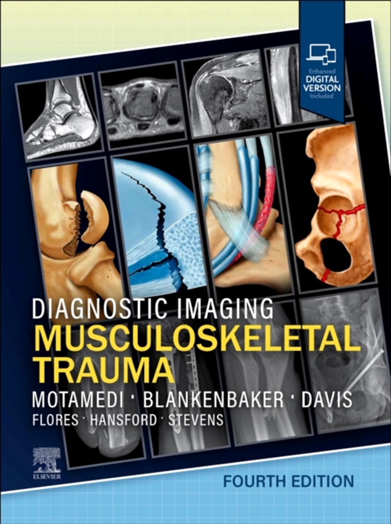 Diagnostic Imaging: Musculoskeletal Trauma/Product Detail/Healthcare