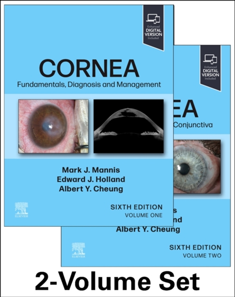 Cornea, 2-Volume Set/Product Detail/Healthcare